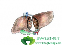 �յ�ԭ���Ըΰ��߷��Ŀ�����������Щ��