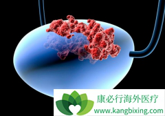 ���װ�����֢״����Щ��