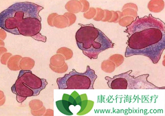 CAR-T�Ʒ��ڶ෢�Թ�����������ȡ����������Ч