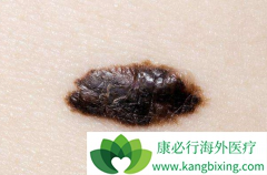 ͷƤ��ɫ�������Ʒ�������Щ�����Ԥ����֢��