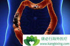 ������ת���Խ�ֱ�����������ƵĴ���ҩ�ﶼ����Щ��