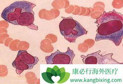 ��ʹ���ٴ��г�������Ķ෢�Թ�����֢״