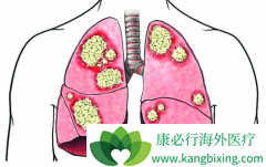 �ӳ������ڷΰ���֢״���ΰ����ڴ����Ҫ��ã�