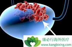 ���װ�Ҳ������ҩ���������Ӧ֢֮һ