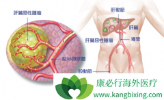 ����������˨���Ʒ����Ƹ�ϸ�������ߵ�Ч����ô����