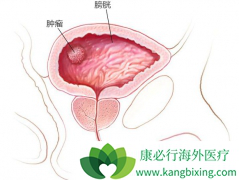 ����ҽ�Ʒ����׸����ڰ��װ����Ƶİ���ҩ��Balversa����Ч���