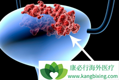 ���װ��Ĳ�����ճ���Ӧ���ĵİ��װ�֢״