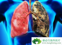 Сϸ���ΰ����ڻ��߷��Ʋ��˳���ÿ��1��