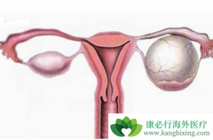 ����������PRAP���Ƽ�������Ϊ�ѳ���ά�����Ƶ�ѡ�񷽰�