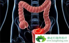 ߻�������Ϊ���ڽ�ֱ�����������Ʊ�׼��ҩ����Ч��Σ�