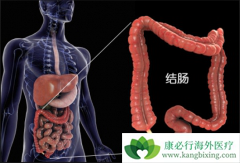 ���̻����ӽ�����Ⱥ���ֱ�����ķ���