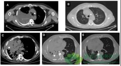 ��ϣ����������ҩ�Ժ���û��Ƽ��������ƿ���ô��