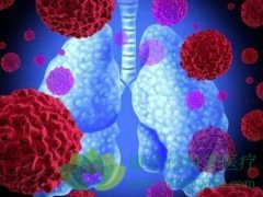 ����������c-MET��ROS1����NSCLC�У�AcS��II������Ľ��