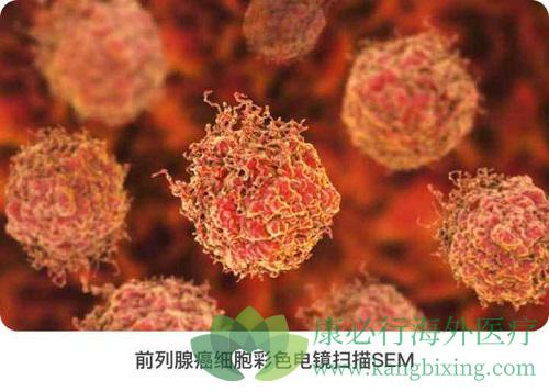 1575632313628651.jpg 前列腺6.jpg