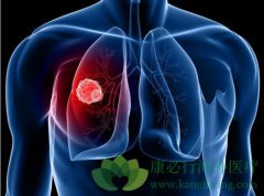 �����������ڷΰ�������Ҫע��Щʲô��