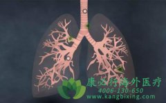 �ΰ������Ļ���ͻ��Ƶ�ʺͰ���ҩ������Щ?