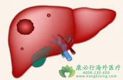 ����³ɳ(EPCLUSA)�밷��ͪ���ûᵼ�����ص��Ķ�����