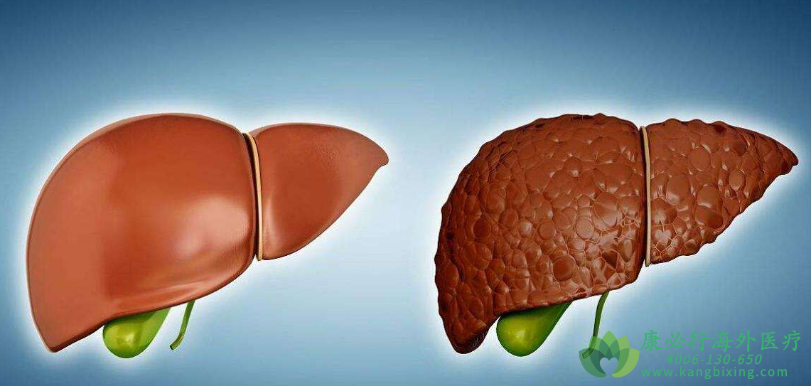 /hcv