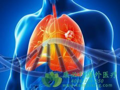 ����ҩ�ﲨ������(Poziotinib)������Exon20 NSCLC��������