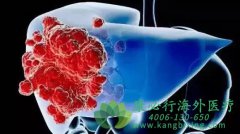 �ΰ�������ѡ��������ƻ������������أ�