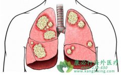 �ΰ����Ʒ�������Щ���ΰ�����ҩ�ķ�չʷ��