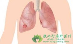 EGFR����ҩ����ɳ�����޿�����Щ������?