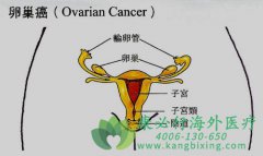 PARP���Ƽ�ά������(Veliparib)�����ѳ����������ݻ���