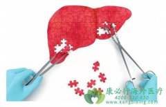 ���͸���(HCV)��ʲô������������ȫ�������Σ�