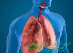 鵥(Soliris/eculizumab)Ƴ񾭼׹ϰ