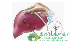 �����鵥��(Soliris/eculizumab)�������Ƴ����񾭼����׹����ϰ���������Ч����