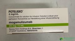 Ī鵥(Mogamulizumab/Poteligo)ĢٴЧڷŵ