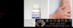 ¿/뮿(Sotyktu/Deucravacitinib)һһĿڷѡԱҰἤøƼ