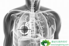 ���Ʒΰ��ķ�����������������Щ���ߣ�