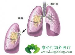 ������ʹ�͹�����ΰ�������ʲô֢״��