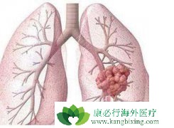 �ΰ�����������Ҫ���ݲ���ȷ��ΰ�����