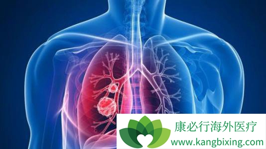 �ΰ����ڻ���������Ӵ��ᵼ�·ΰ����ڻᴫȾ��