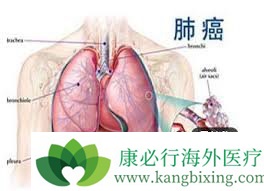 ȷ�Ϸΰ���ת��֢״��Ӧ���������