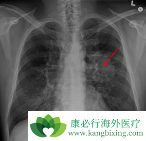 �ΰ��������ܻ�����ΰ����Ʒ����кܴ��ϵ