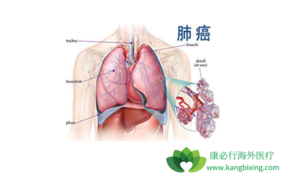 �ΰ���չ���˷ΰ����ڴ�Ⱦ��