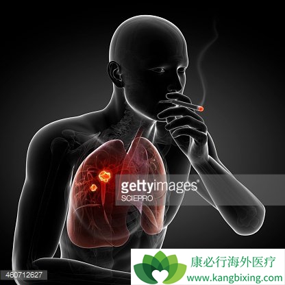 �����ķΰ����Ʒ����ĸ���������Щ��