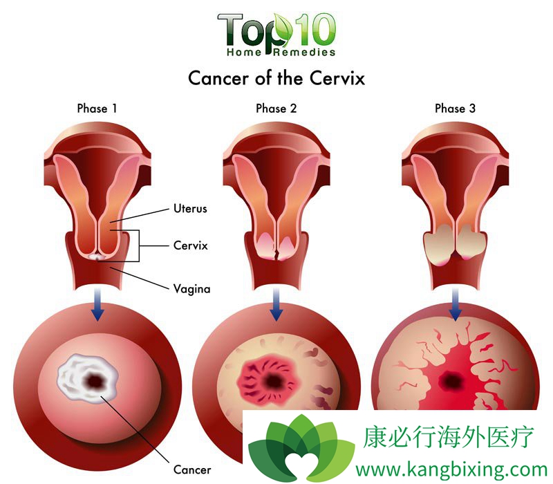 ���繬�����Ȱ�֢��Ⱦ��