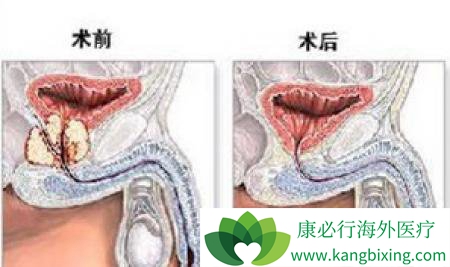 ����ǰ���ٰ�֮ǰ����Ҫ�˽�ǰ���ٰ�֢״