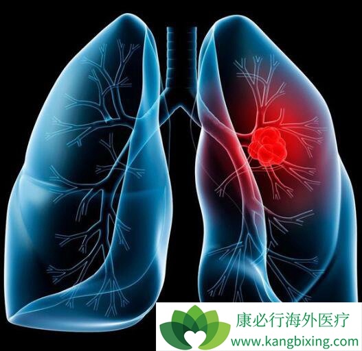 ���������ȼ�����������ӳ��޽�չ�����ڵ�����