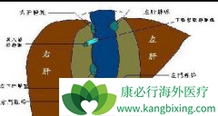 ������ֲ��ٿƣ���ͯ������ֲ��ʷ����ֲ����Ӧ�߱���Щ����?