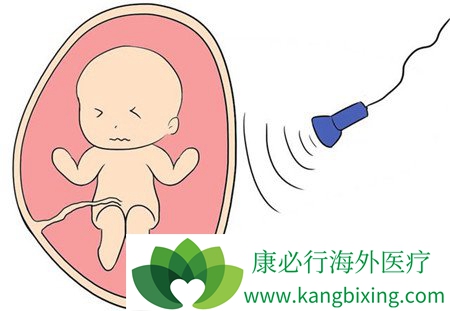 做试管婴儿后成功怀上了,预产期怎么算?