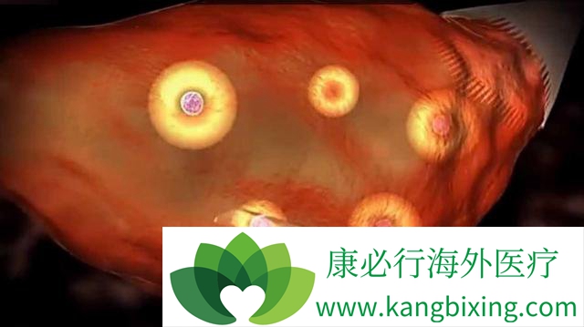 做试管婴儿最受罪的是哪个环节?