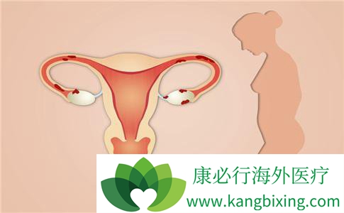 子宫内膜太薄做试管婴儿能成功吗