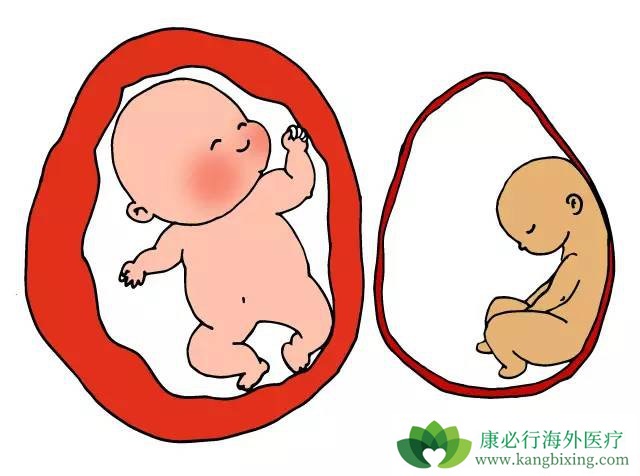 子宫内膜太薄做试管婴儿能成功吗