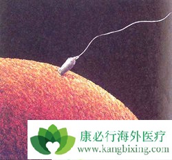 做试管婴儿是在国内做还是选择国外?