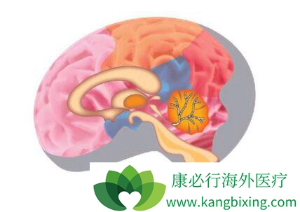 脑肿瘤细胞